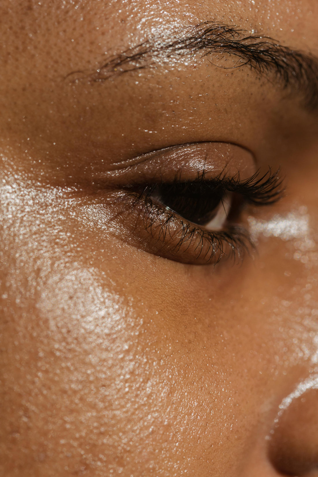 How to Get Rid of Dark Circles Under the Eyes: Effective Tips and Remedies